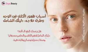 فتاة بوجه فيه كلف وشرح مختصر لفكرة المقالة